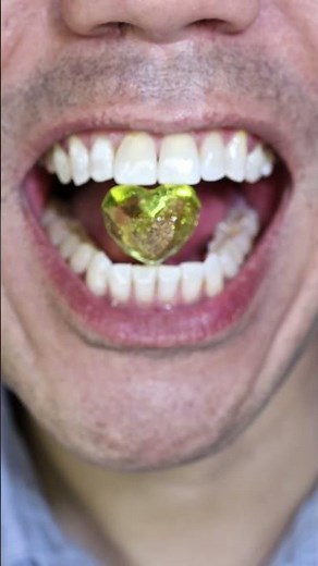 ASMR | Sweetest Heart Candy Ever 💛🍬 #DoctorTristanPeh #ASMR