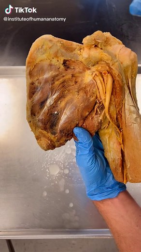 Understanding the Female Armpit Muscle Anatomy for Better Health