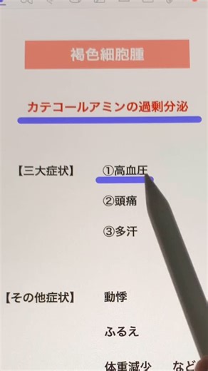 いがちゃん | 現役講師が教える医療国試対策 on Instagram: "今回は副腎髄質ホルモンと褐色細胞腫について 褐色細胞腫は最近国家試験でも 選択肢の中でよく見かけるようになってきました。 なんか見たことあるなぁで 終わらせないで今のうちに覚えておきましょう。 国試まで残り8ヶ月なので そろそろ本格的に国試対策はじめましょう！ 学校よりわかりやすい国試対策はこちらをフォロー👇 @igachan_kokusi #国試対策 #国家試験 #看護学生 #看護師国家試験 #看護学生の勉強垢 #第115回看護師国家試験 #鍼灸学生 #鍼灸師 #解剖学 #生理学 #内分泌"