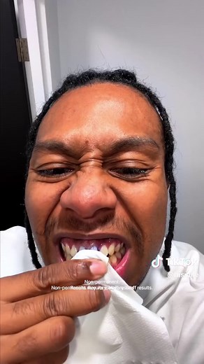 Dentist Tests V34 Color Corrector for Teeth Whitening | Demo Included!