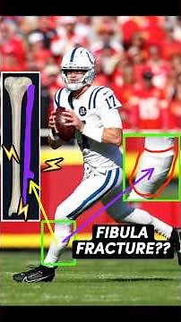 Doctor explains how Daniel Jones is playing thru fibula fracture #Colts #FantasyFootball #Education