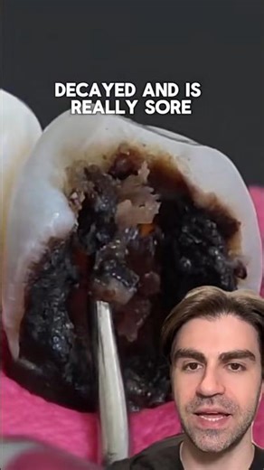 How To SAVE This Tooth (Step By Step)