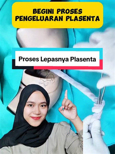 Proses Lepasnya Plasenta Setelah Melahirkan
