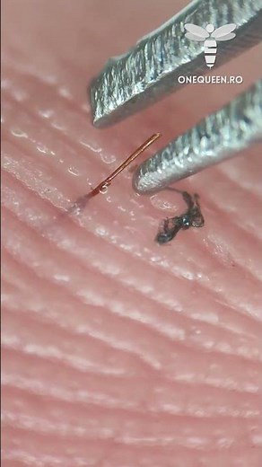 The bee's stinger is perfectly designed by nature to deliver the maximum amount of venom