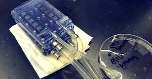 Bioartificial kidney prototype aces lab tests, could replace dialysis