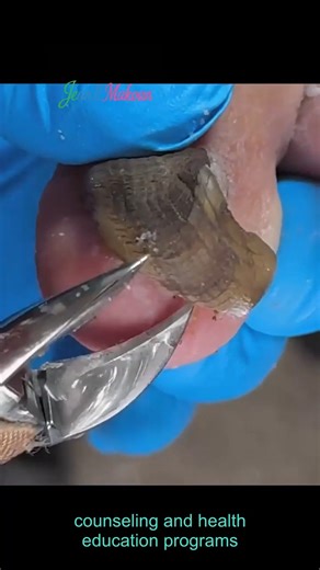 43K views · 274 reactions | Foot Health Tips For Outdoor Photographers #OutdoorCare #fblifestyles | Jean II Makoun | Facebook