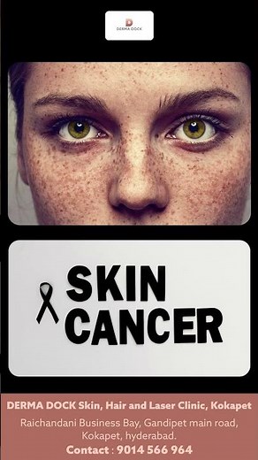 Freckles or Age Spots? | The Main Causes Behind Freckles and Age Spots Explained #dermadock