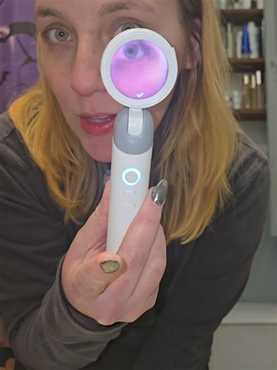 Digital Otoscope for Quick Ear Check-ups at Home