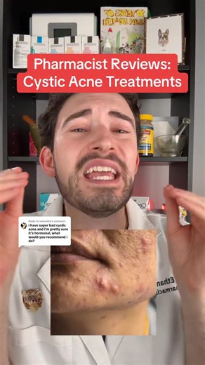 Cystic Acne 101 from a pharmacist. Let’s review all options possible to help you determine what’s the best one for you! | MillennialRx