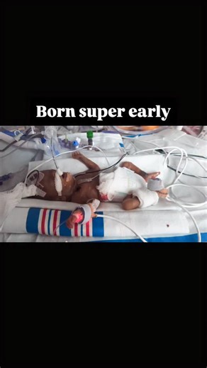 Remember her name: Edith Rose Her story is one of one. #EdithStrong #TeamEdith #Milagro | Pepper Smith Pyle