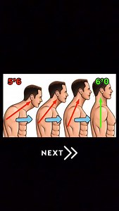 How to fix straight neck | Fitness Tip