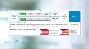Life Line Screening on Reels | Facebook