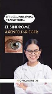 Axenfeld-Rieger: the rare disease that can hide severe glaucoma