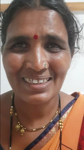 Hemifacial Spasm (Description by Dr Sudhir Kumar Neurologist)