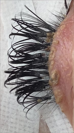 Please listen to your lash techs & clean your lashes ✨ #trending #beauty #lashextensions #eyelashextensions #lashes #makeup #spmu #badlashes #ifb #duet