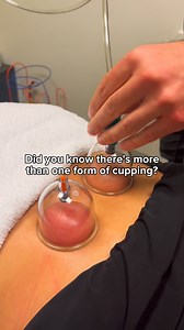Have you tried cupping before? Did you know that there are different...