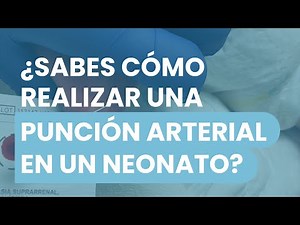👶🩸 Do you know how to perform an arterial puncture on a newborn? 👶🩸 Medicarama explains it to you...