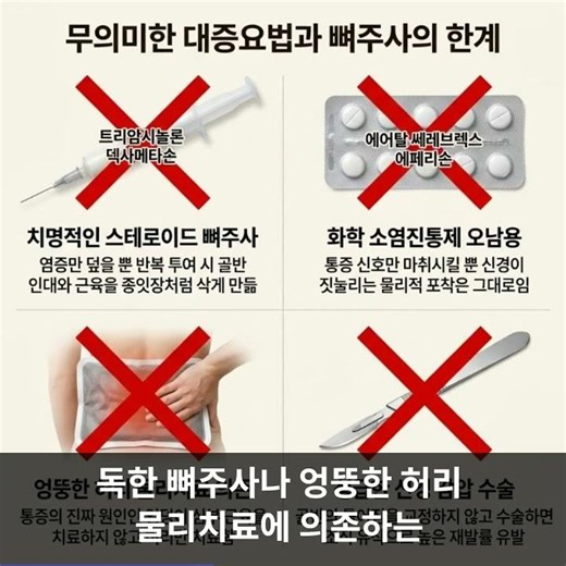 이상근증후군과 좌골신경통 감별 진단 및 엉덩이 통증 다리 저림을 치료하는 4단계 구조 복원 솔루션