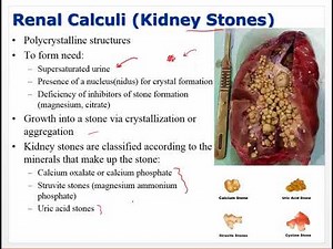 Ch 30 Urinary and Renal Disorders