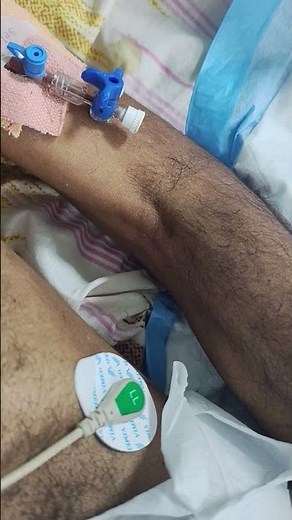 wasting of Thenar muscles and fasciculations in a patient with MND