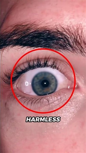 If Your Vision Suddenly Gets Blurry… Don’t Ignore This