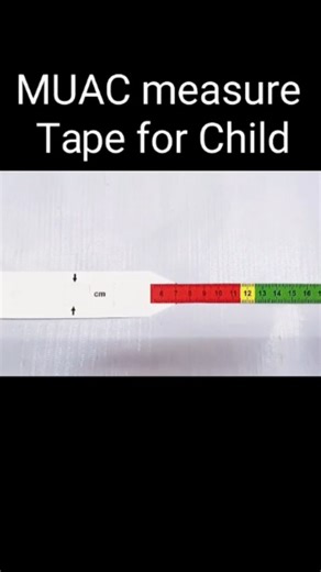 Spancare Pharmaceuticals on Instagram: "🩺 MUAC Measure Tape for Child – PVC, Reusable, Deluxe Quality (Set of 100) High-quality MUAC (Mid-Upper Arm Circumference) measuring tape designed for accurate assessment of child nutrition and health status. Made from durable PVC material, this reusable deluxe-quality tape is easy to use, long-lasting, and suitable for health camps, anganwadi centers, hospitals, clinics, and community health programs. Supplied as a set of 100 tapes for large-scale screen