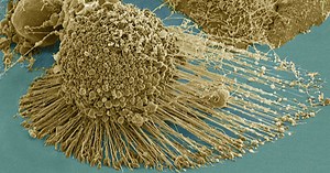 10 Amazing Facts About The Immortal Cells Of Henrietta Lacks