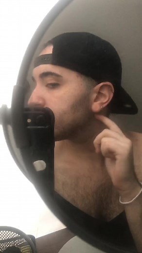 less than 12 hours until top surgery! #KeepingItCute #HiddenTalents #trans #nonbinary #foryoupage #fyp #topsurgery #ftm #transition #nb