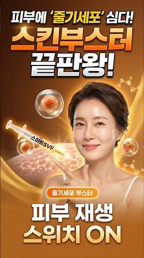 줄기세포 스킨부스터 스마트SVF~!! 지방은 줄이고, 피부는 살리는 2가지 효과가 동시에! #스킨부스터 #줄기세포시술 #피부시술