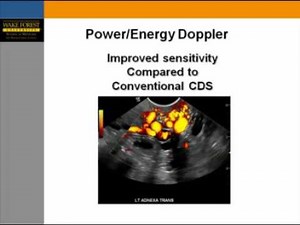 Color Doppler During Abdominal Ultrasound Techniques, Applications and Pitfalls
