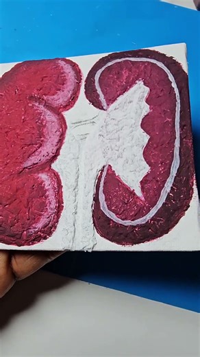 Kidney Anatomy Art, Part 2 #anatomyart #anatomy #anatomydrawing #kidneyawareness #kidneyhealth
