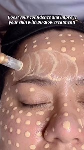 Boost your confidence and reveal your natural glow  Our BB Glow Treatment helps brighten, smooth, and hydrate your skin — for that fresh, flawless finish you’ll love! | Glam And Glow Beauty Expert | Facebook