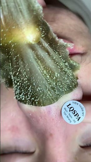 毛穴の角栓黒ずみをごっそり吸引 blackhead removal パート10