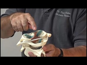 Transverse ligament damage (Severely broken neck)