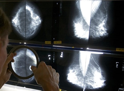 Highmark eliminates out of pocket costs for breast cancer studies, MRIs