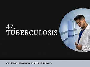 47. Tuberculosis