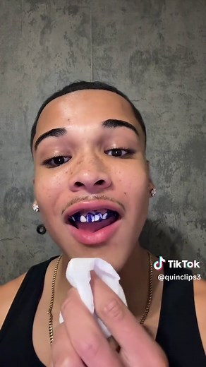 Whiten Your Teeth with Affordable Veneers