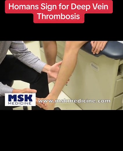 Homan’s Sign for Deep Vein Thrombosis (DVT) Clinical Test