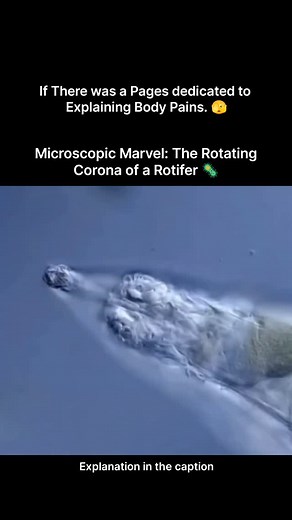 BIOLOGY | HEALTHCARE | MEDICINAL on Instagram: "This mesmerizing microscopic view reveals a rotifer, a tiny aquatic organism known for its remarkable feeding structure called the corona. The corona appears to rotate, but in reality, it is made of rapidly beating cilia that create powerful water currents. These currents pull in food particles such as algae and bacteria, guiding them toward the rotifer’s mouth with incredible precision. Beyond feeding, the corona also helps the rotifer move throug