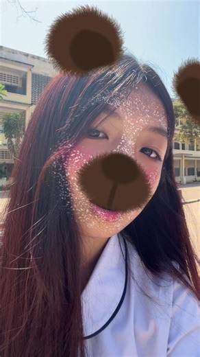 Chinnn
