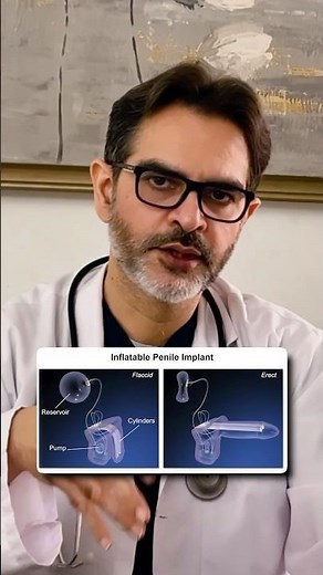 Malleable Vs Inflatable Penile Implant #erectiledysfunction