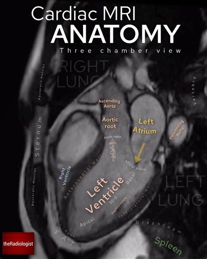 the Radiologist | Radiology on Instagram: "MRI anatomy collection: swipe left for 17 images from the brain, spine, heart, abdomen and pelvis. 📲 Be sure to follow @theradiologistpage for more anatomy posts"