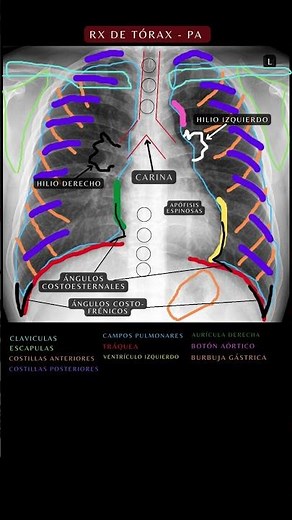 Radiografía de Tórax PA | Anatomía del Tórax #radiografía #anatomía #medicina