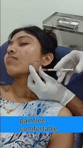 masseter muscle hypertrophy #jawlinecontouring #MasseterHypertrophy #BotulinumToxin #FacialSlimming