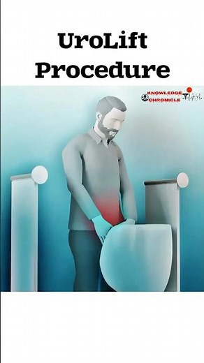 UroLift Procedure Explained: A Modern Solution for Enlarged Prostate (BPH) #shorts #trending