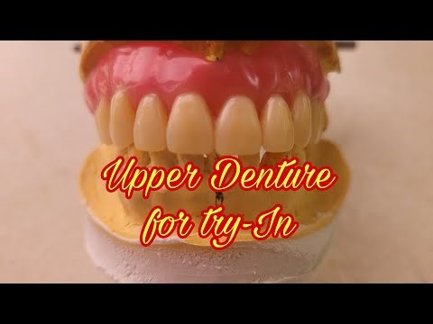 Set-up Done for Trial Fitting | Partial Denture