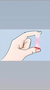 Vaginal discharge is a clear or whitish fluid that comes out of your vagina. Discharge is normal, but changes in the amount, consistency, color or smell could indicate an infection or other problem. | Med G