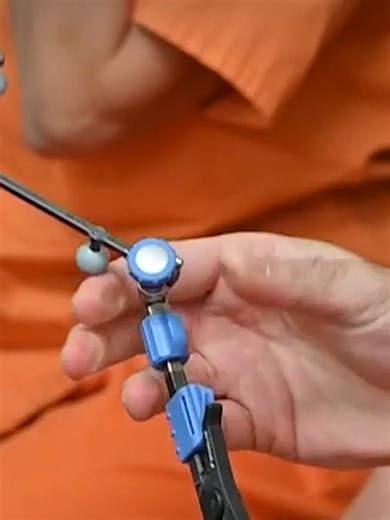 Operación pionera salva la pierna de un niño con cáncer