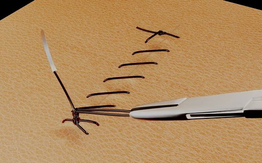 【缝合技巧】【连续缝合】Suture Techniques：Running Simple Suture - 连续缝合动画演示