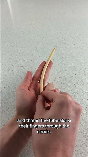 Pregnancy Induction Of Labor Methods (Cervical Ripening Balloon) - Foley Balloon Induction